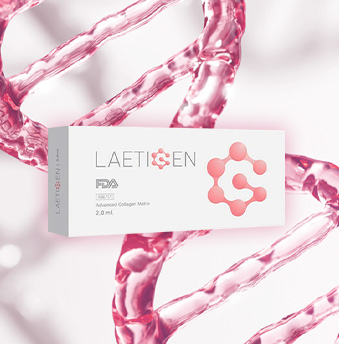 LAETIGEN